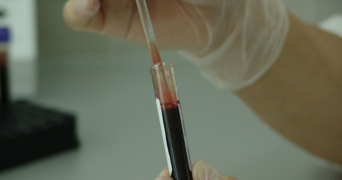 Naukowcy odkrywaja nowa metode leczenia raka